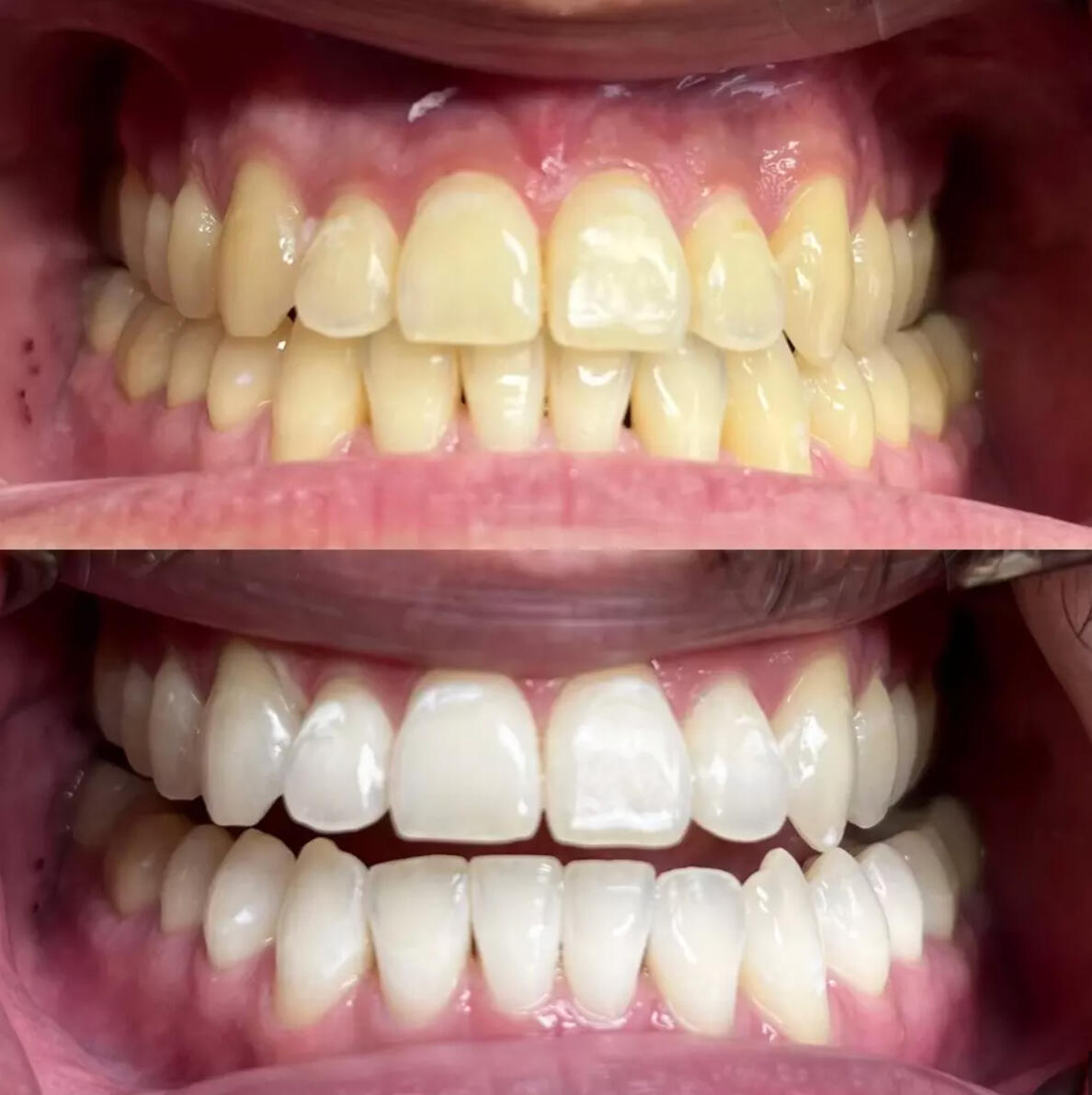 Faucibus nisl tincidunt